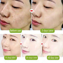 SHRINK EFFACLAR SÉRUM ULTRA CONCENTRADO