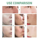 SHRINK EFFACLAR SÉRUM ULTRA CONCENTRADO