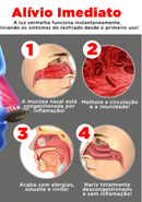 APARELHO DE TERAPIA NASAL DO MISTER